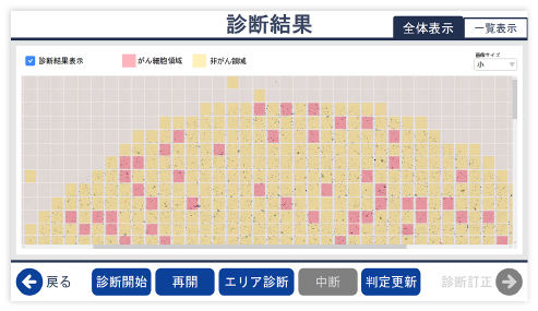 WSI画像診断結果