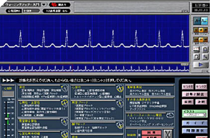 心電図トレーニングソフト
